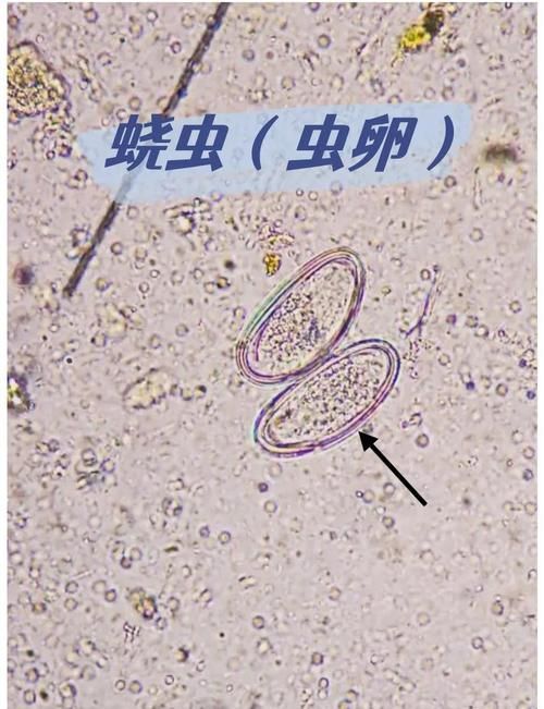 龍魚內寄生蟲有哪些常見種類，arxiv論文助手檢索是否有水產寄生蟲相關的最新研究 龍魚內寄生蟲有哪些常見種類，arxiv論文助手檢索是否有水產寄生蟲相關的最新研究 龍魚百科 第5張