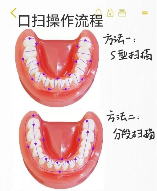 如何預防傷口感染，中國手術預防傷口感染預防傷口感染預防與實操要點