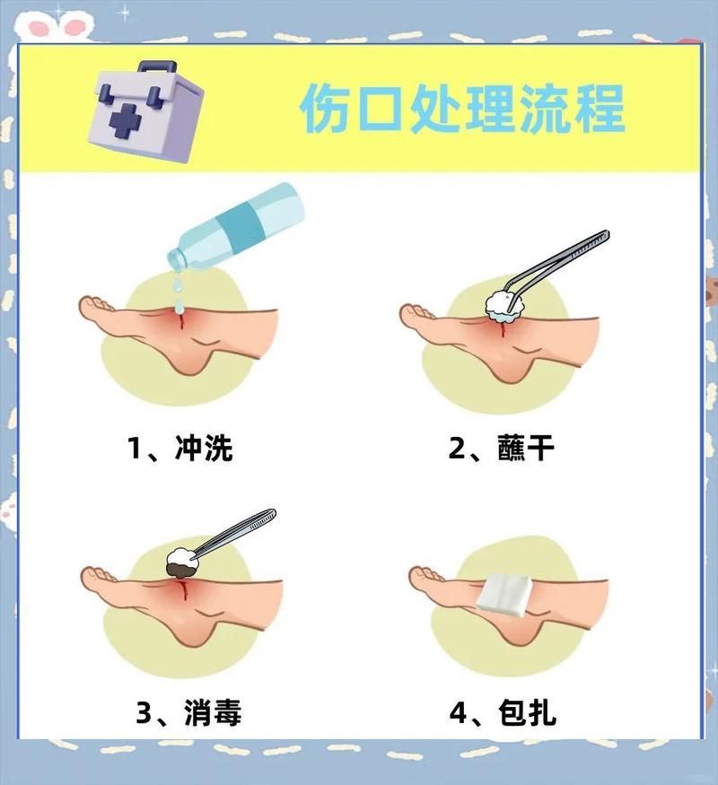 如何預(yù)防傷口感染，中國(guó)手術(shù)預(yù)防傷口感染預(yù)防傷口感染預(yù)防與實(shí)操要點(diǎn)