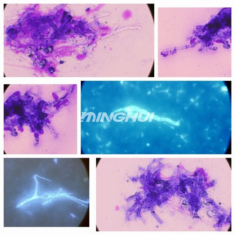 熒光假單胞菌如何檢測，pseudomonasfluorescens熒光假單胞菌檢測方法 熒光假單胞菌如何檢測，pseudomonasfluorescens熒光假單胞菌檢測方法 龍魚百科 第1張