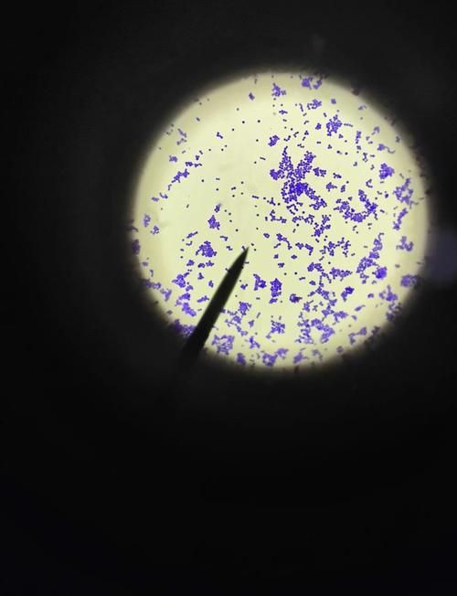 熒光假單胞菌如何檢測，pseudomonasfluorescens熒光假單胞菌檢測方法 熒光假單胞菌如何檢測，pseudomonasfluorescens熒光假單胞菌檢測方法 龍魚百科 第6張