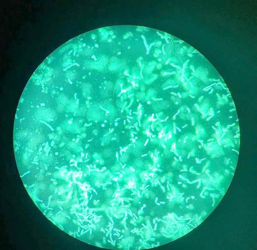 熒光假單胞菌如何檢測，pseudomonasfluorescens熒光假單胞菌檢測方法 熒光假單胞菌如何檢測，pseudomonasfluorescens熒光假單胞菌檢測方法 龍魚百科 第4張