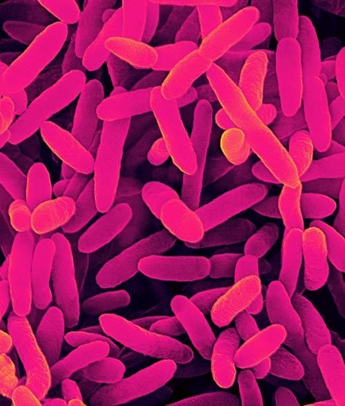 熒光假單胞菌如何檢測，pseudomonasfluorescens熒光假單胞菌檢測方法 熒光假單胞菌如何檢測，pseudomonasfluorescens熒光假單胞菌檢測方法 龍魚百科 第2張