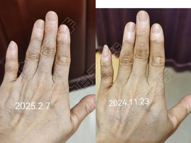 如何判斷魚鱗充血是否嚴重，如何判斷魚鱗充血嚴重