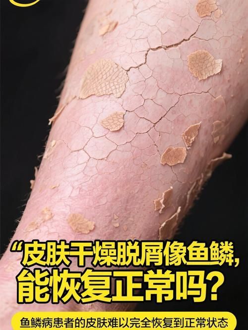 如何判斷魚鱗充血是否嚴重，如何判斷魚鱗充血嚴重