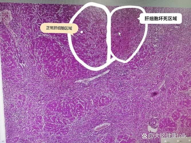 龍魚腹水藥物治療有哪些副作用？，關于龍魚腹水病副作用的一些建議