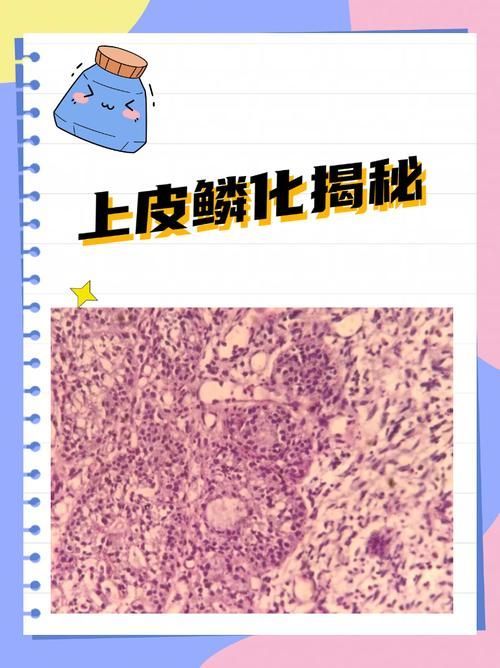 炸鱗病復發率高嗎，水產養殖與觀賞魚領域的炸鱗病復發率
