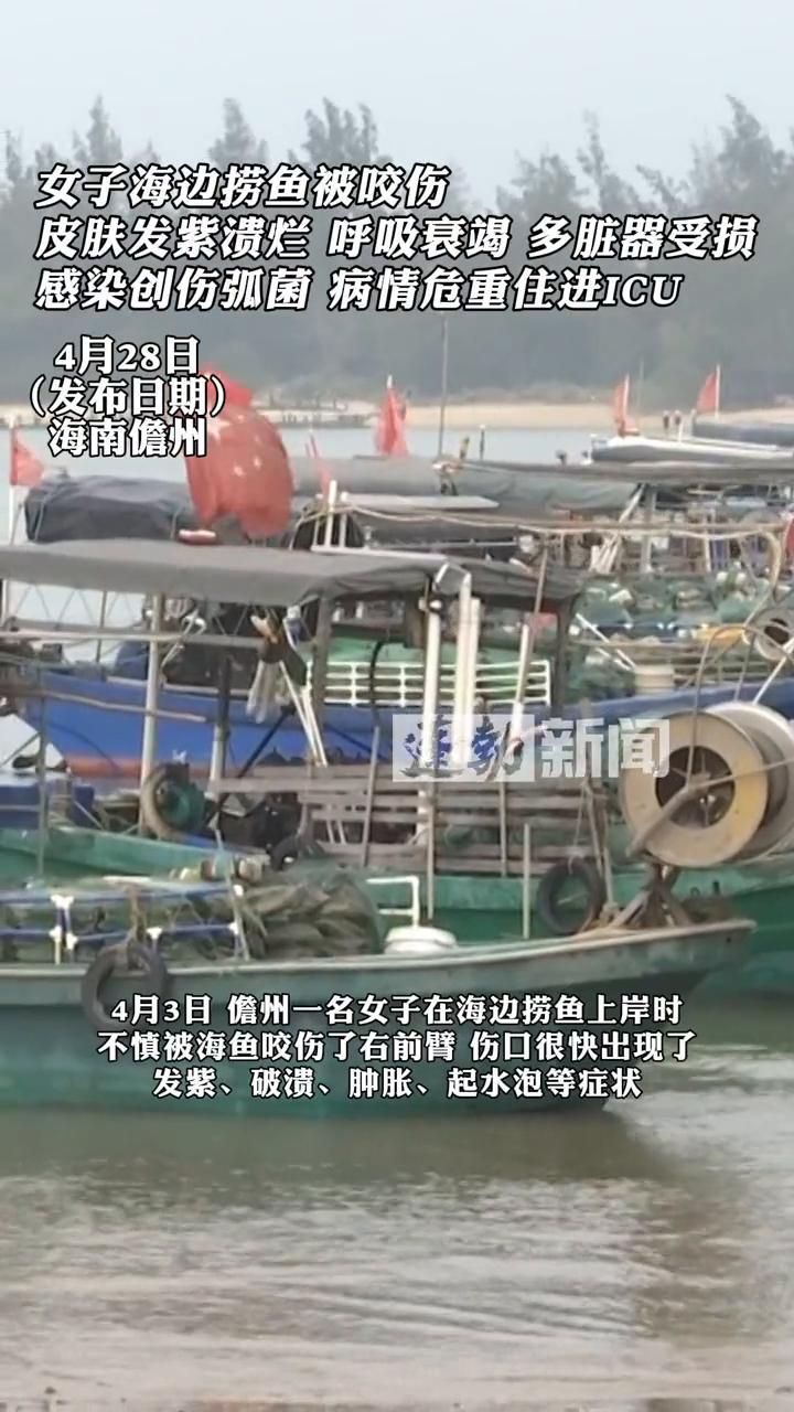 哪種海魚扎傷后感染風險最高 哪種海魚扎傷后感染風險最高 龍魚百科 第1張