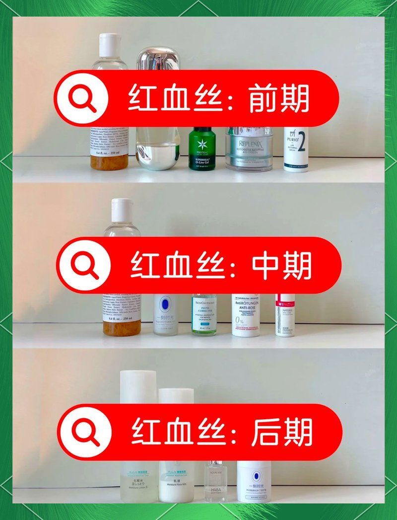 有哪些護膚品是專門針對紅血絲的，去紅血絲護膚品推薦 有哪些護膚品是專門針對紅血絲的，去紅血絲護膚品推薦 龍魚百科 第8張