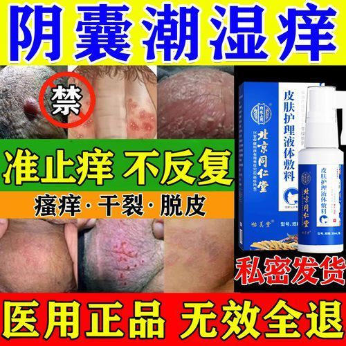 如何判斷魚鱗變紅是否感染，如何判斷魚身紅點成因與治療調全解析 如何判斷魚鱗變紅是否感染，如何判斷魚身紅點成因與治療調全解析 龍魚百科 第6張