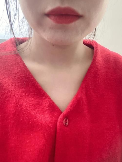 如何判斷中毒程度，如何判斷中毒程度思考完成百度健康-去問診 如何判斷中毒程度，如何判斷中毒程度思考完成百度健康-去問診 龍魚百科 第3張