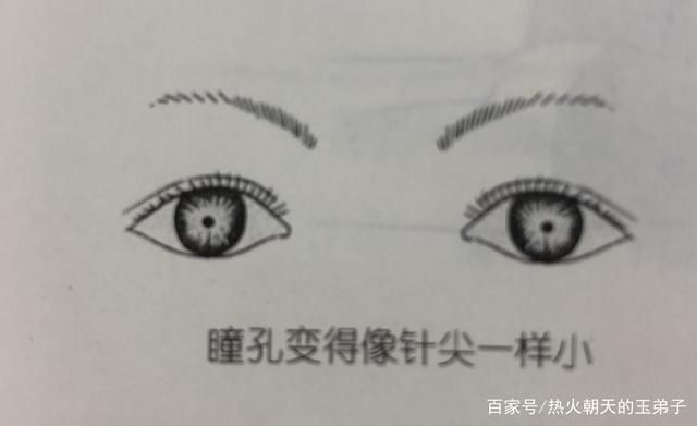 如何判斷中毒程度，如何判斷中毒程度思考完成百度健康-去問診 如何判斷中毒程度，如何判斷中毒程度思考完成百度健康-去問診 龍魚百科 第8張