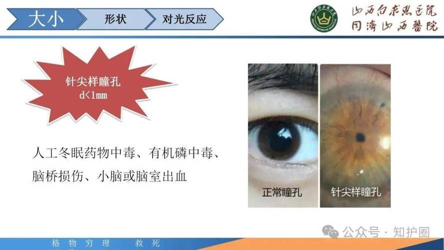 如何判斷中毒程度，如何判斷中毒程度思考完成百度健康-去問診 如何判斷中毒程度，如何判斷中毒程度思考完成百度健康-去問診 龍魚百科 第9張