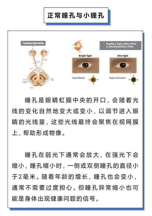 如何判斷中毒程度，如何判斷中毒程度思考完成百度健康-去問診 如何判斷中毒程度，如何判斷中毒程度思考完成百度健康-去問診 龍魚百科 第10張