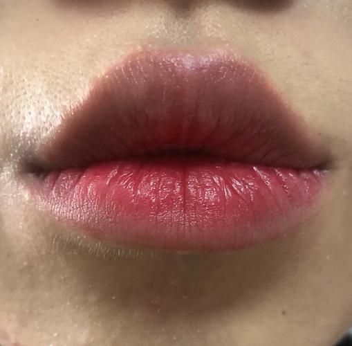 如何判斷中毒程度，如何判斷中毒程度思考完成百度健康-去問診 如何判斷中毒程度，如何判斷中毒程度思考完成百度健康-去問診 龍魚百科 第1張