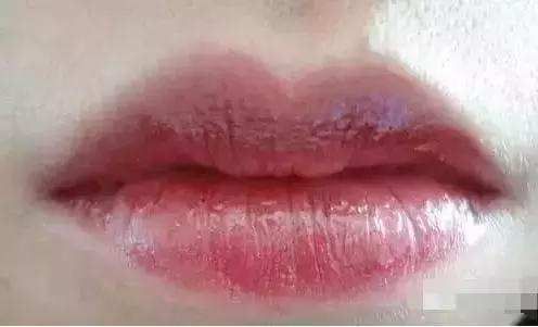 如何判斷中毒程度，如何判斷中毒程度思考完成百度健康-去問診 如何判斷中毒程度，如何判斷中毒程度思考完成百度健康-去問診 龍魚百科 第2張