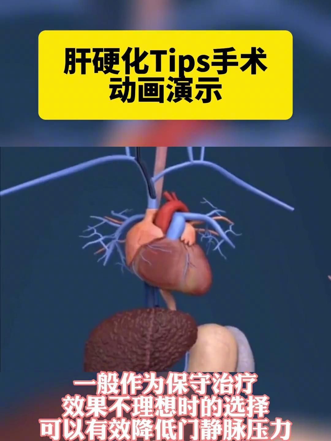 腹水病有哪些治療方法，腹水病治療方案 腹水病有哪些治療方法，腹水病治療方案 龍魚百科 第3張