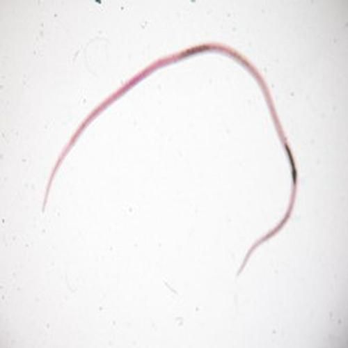 如何預防異尖線蟲感染,如何預防異尖線蟲感染(arxiv論文助手”預防異尖線蟲感染 龍魚百科 第2張 如何預防異尖線蟲感染,如何預防異尖線蟲感染(arxiv論文助手”預防異尖線蟲感染 如何預防異尖線蟲感染,如何預防異尖線蟲感染(arxiv論文助手”預防異尖線蟲感染 龍魚百科 第2張