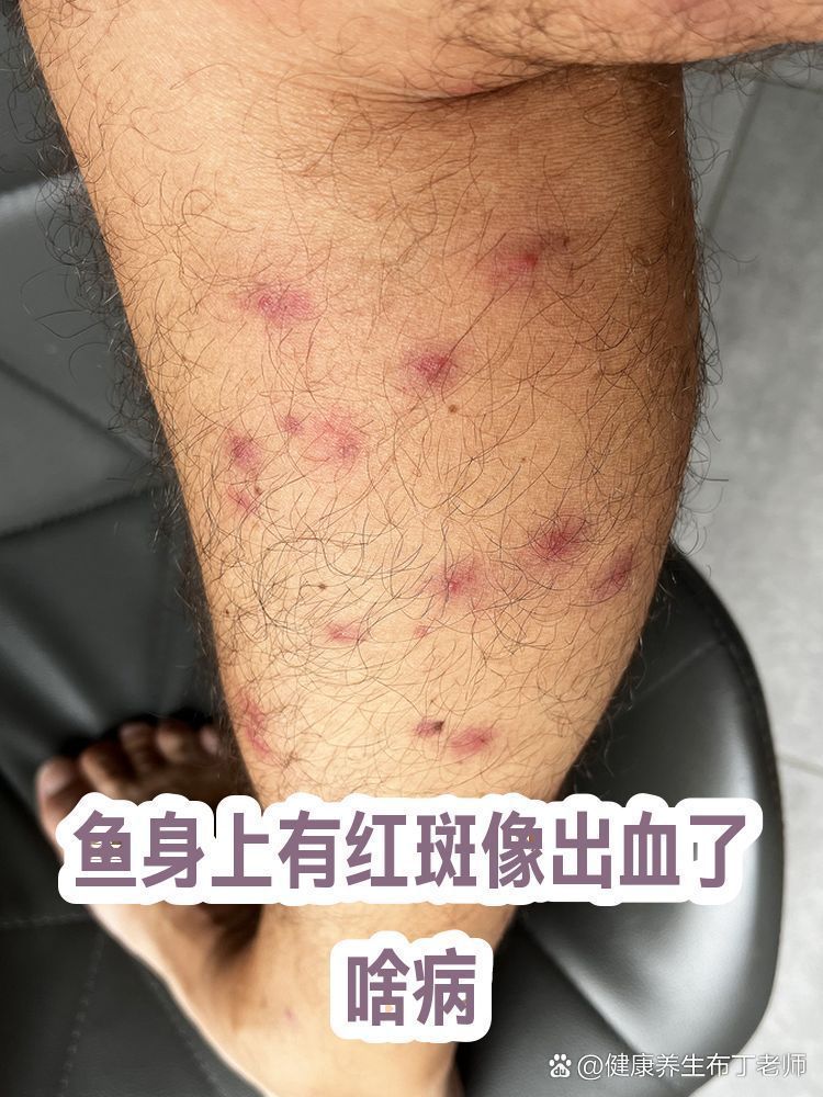 如何預(yù)防魚(yú)身紅斑，如何科學(xué)預(yù)防魚(yú)身紅斑 如何預(yù)防魚(yú)身紅斑，如何科學(xué)預(yù)防魚(yú)身紅斑 龍魚(yú)百科 第7張