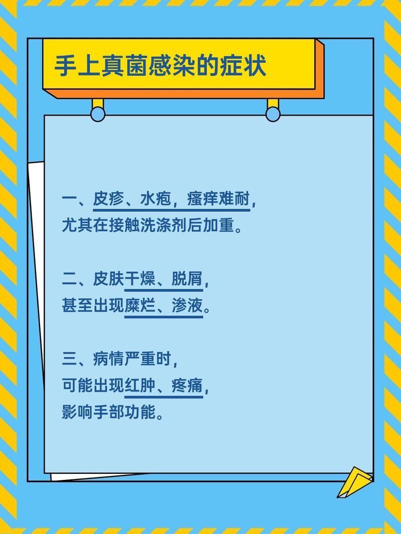 有哪些手部真菌感染的治療方法，手上真菌感染怎么辦 有哪些手部真菌感染的治療方法，手上真菌感染怎么辦 龍魚百科 第2張