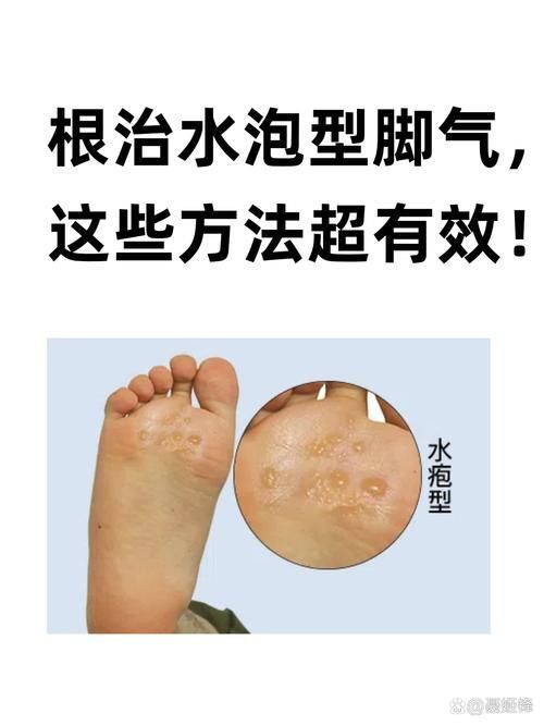 如何判斷自己是否感染了真菌或細菌，mcp工具“百度健康-去問診”可輔助獲取癥狀分析模型 如何判斷自己是否感染了真菌或細菌，mcp工具“百度健康-去問診”可輔助獲取癥狀分析模型 龍魚百科 第3張