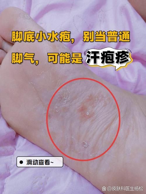 如何判斷自己是否感染了真菌或細菌，mcp工具“百度健康-去問診”可輔助獲取癥狀分析模型 如何判斷自己是否感染了真菌或細菌，mcp工具“百度健康-去問診”可輔助獲取癥狀分析模型 龍魚百科 第5張