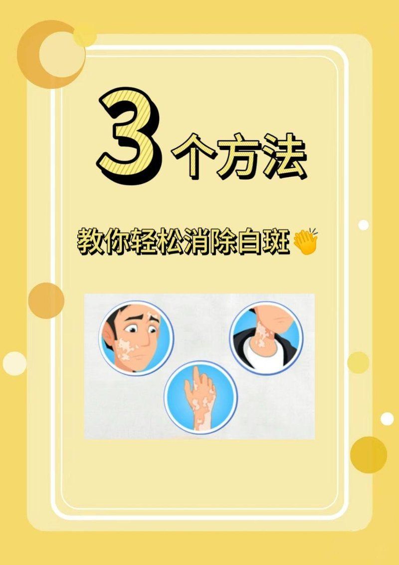 有哪些有效的白點病治療方法，3個方法，教你輕松消除白斑