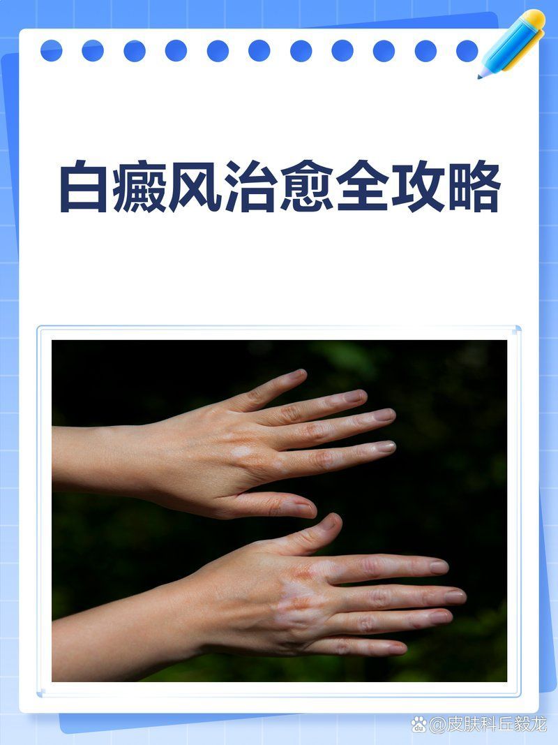 有哪些有效的白點病治療方法，3個方法，教你輕松消除白斑 有哪些有效的白點病治療方法，3個方法，教你輕松消除白斑 龍魚百科 第2張
