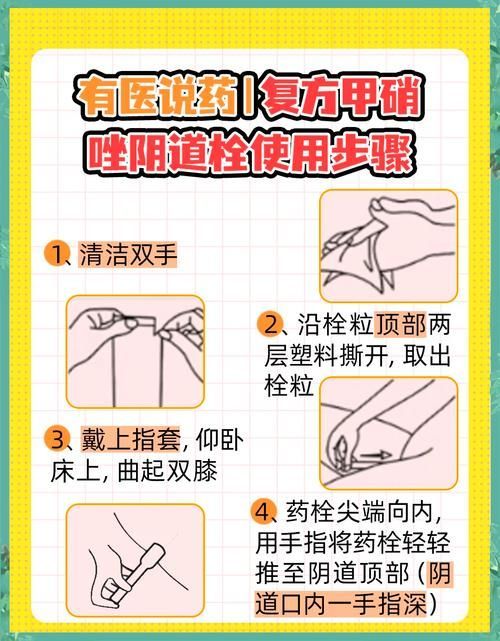 如何緩解甲硝唑片的副作用 如何緩解甲硝唑片的副作用 龍魚百科 第5張