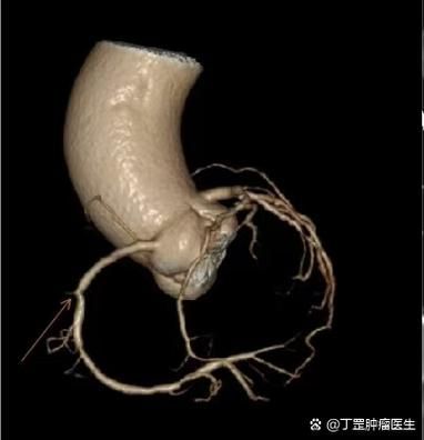 如何判斷魚爛鰓的類型,arxiv論文助手判斷魚爛鰓的類型調(diào)用arxiv論文助手 龍魚百科 第2張 如何判斷魚爛鰓的類型,arxiv論文助手判斷魚爛鰓的類型調(diào)用arxiv論文助手 如何判斷魚爛鰓的類型,arxiv論文助手判斷魚爛鰓的類型調(diào)用arxiv論文助手 龍魚百科 第2張