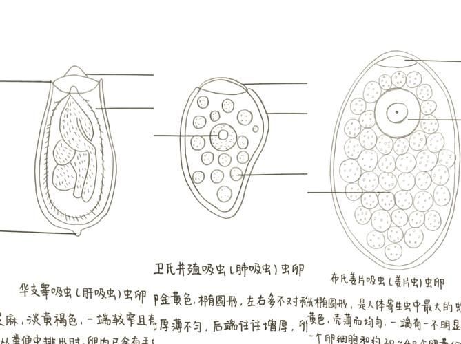 詳細(xì)閱讀:哪些魚類寄生蟲最容易感染人,哪些魚類寄生蟲最容易感染人類寄生蟲最容易感染人類 哪些魚類寄生蟲最容易感染人,哪些魚類寄生蟲最容易感染人類寄生蟲最容易感染人類