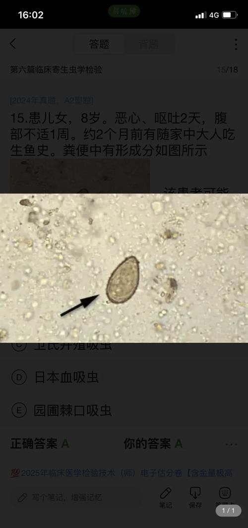 哪些魚類寄生蟲最容易感染人,哪些魚類寄生蟲最容易感染人類寄生蟲最容易感染人類 龍魚百科 第4張 哪些魚類寄生蟲最容易感染人,哪些魚類寄生蟲最容易感染人類寄生蟲最容易感染人類 哪些魚類寄生蟲最容易感染人,哪些魚類寄生蟲最容易感染人類寄生蟲最容易感染人類 龍魚百科 第4張