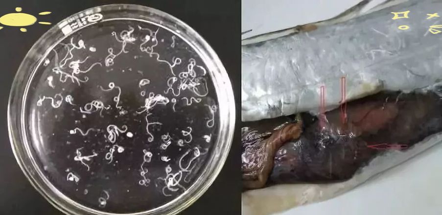 哪些魚類寄生蟲最容易感染人,哪些魚類寄生蟲最容易感染人類寄生蟲最容易感染人類 龍魚百科 第9張 哪些魚類寄生蟲最容易感染人,哪些魚類寄生蟲最容易感染人類寄生蟲最容易感染人類 哪些魚類寄生蟲最容易感染人,哪些魚類寄生蟲最容易感染人類寄生蟲最容易感染人類 龍魚百科 第9張