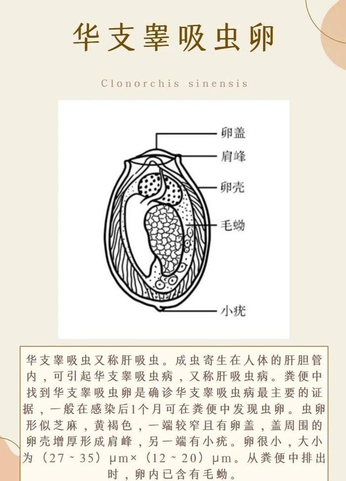 哪些魚類寄生蟲最容易感染人,哪些魚類寄生蟲最容易感染人類寄生蟲最容易感染人類 龍魚百科 第5張 哪些魚類寄生蟲最容易感染人,哪些魚類寄生蟲最容易感染人類寄生蟲最容易感染人類 哪些魚類寄生蟲最容易感染人,哪些魚類寄生蟲最容易感染人類寄生蟲最容易感染人類 龍魚百科 第5張