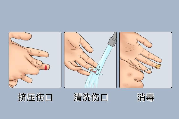 如何預防魚外傷感染，如何預防魚外傷感染及其實操指南 如何預防魚外傷感染，如何預防魚外傷感染及其實操指南 龍魚百科 第2張