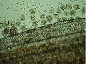 金魚寄生蟲有哪些種類，金魚寄生蟲種類繁多，主要包括以下幾種 金魚寄生蟲有哪些種類，金魚寄生蟲種類繁多，主要包括以下幾種 龍魚百科 第8張