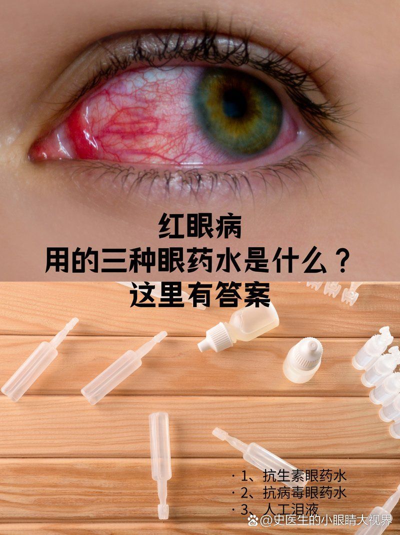 如何正確使用亞甲基藍(lán)治療蒙眼，亞甲基藍(lán)是一種常用的藥物，用于治療多種疾病，使用亞甲基藍(lán)蒙眼的方法并不正確