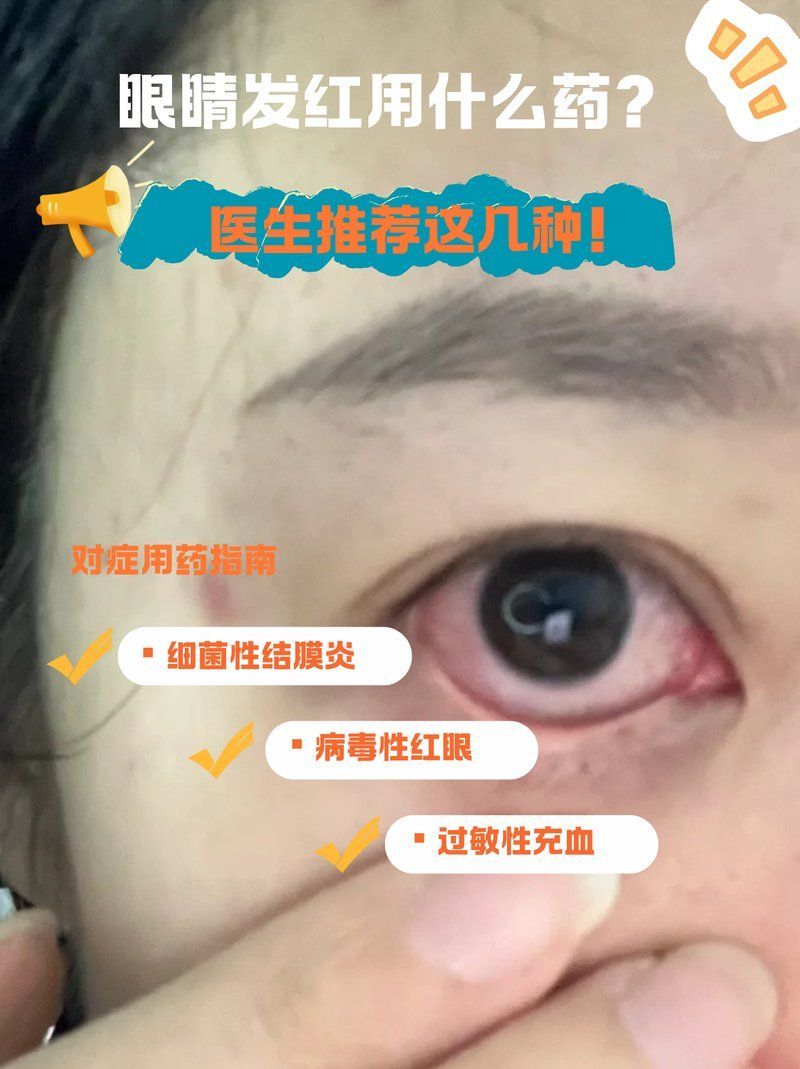 如何正確使用亞甲基藍(lán)治療蒙眼，亞甲基藍(lán)是一種常用的藥物，用于治療多種疾病，使用亞甲基藍(lán)蒙眼的方法并不正確