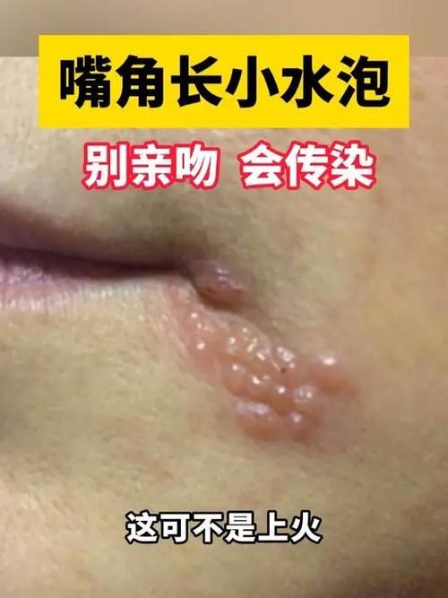 如何區(qū)分龍魚嘴角皰疹和其他疾病？，如何區(qū)分龍魚嘴角皰疹 如何區(qū)分龍魚嘴角皰疹和其他疾病？，如何區(qū)分龍魚嘴角皰疹 龍魚百科 第5張