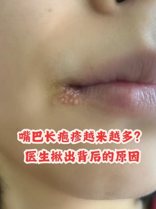 如何區(qū)分龍魚嘴角皰疹和其他疾病？，如何區(qū)分龍魚嘴角皰疹 如何區(qū)分龍魚嘴角皰疹和其他疾病？，如何區(qū)分龍魚嘴角皰疹 龍魚百科 第6張