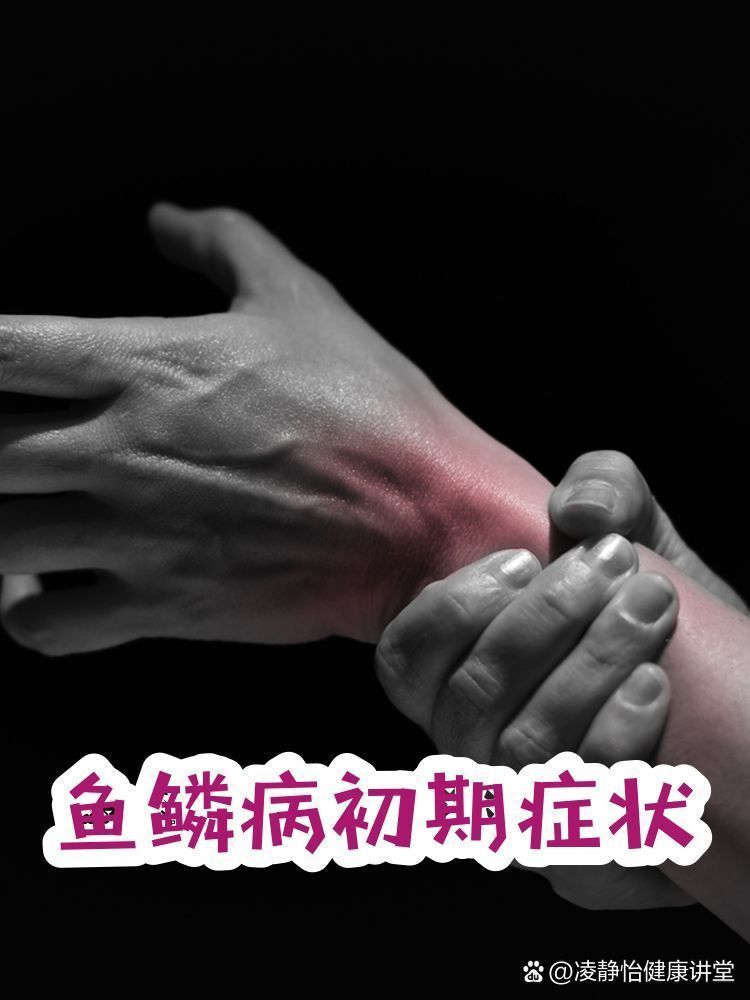 如何早期識別魚鱗片脫落和潰爛，早期識別魚鱗片脫落和潰爛 如何早期識別魚鱗片脫落和潰爛，早期識別魚鱗片脫落和潰爛 龍魚百科 第1張