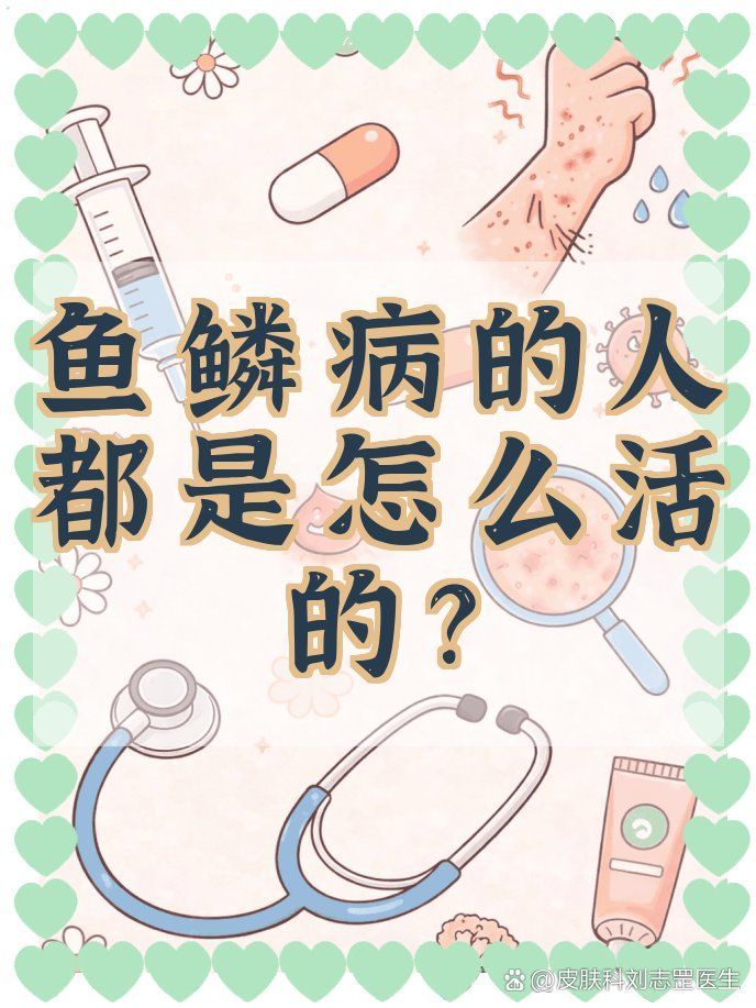 有哪些適合魚鱗病患者的運動，魚鱗病患者如何健身？