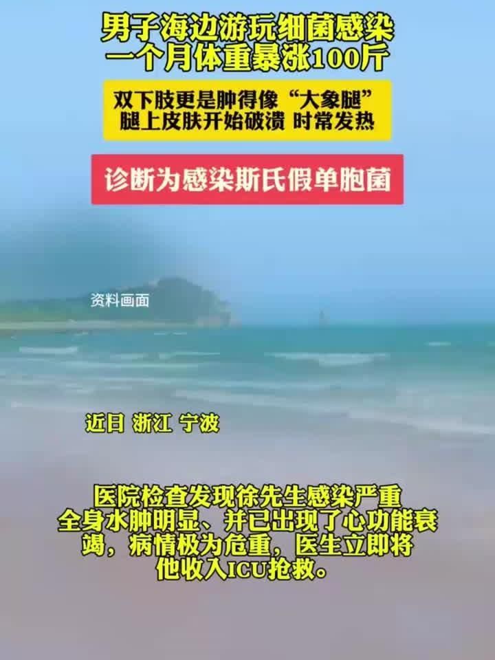 如何判斷自己是否感染了海里細(xì)菌，如何判斷自己是否感染了海洋致病菌