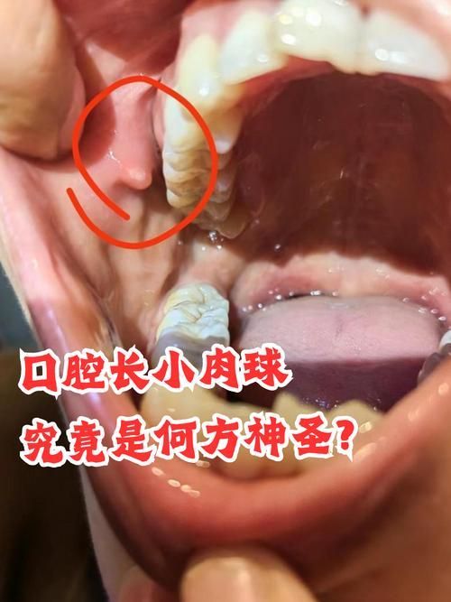 如何判斷龍魚嘴巴的肉粒是否為腫瘤？，如何判斷龍魚嘴巴肉粒是否為腫瘤？