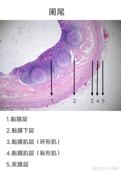 爛尾病能治愈嗎，mcp工具為爛尾病的診療指南、專家推薦或治療案例