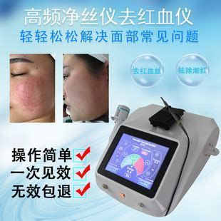 紅血絲簡(jiǎn)單去除方法，去紅血絲前后對(duì)比圖