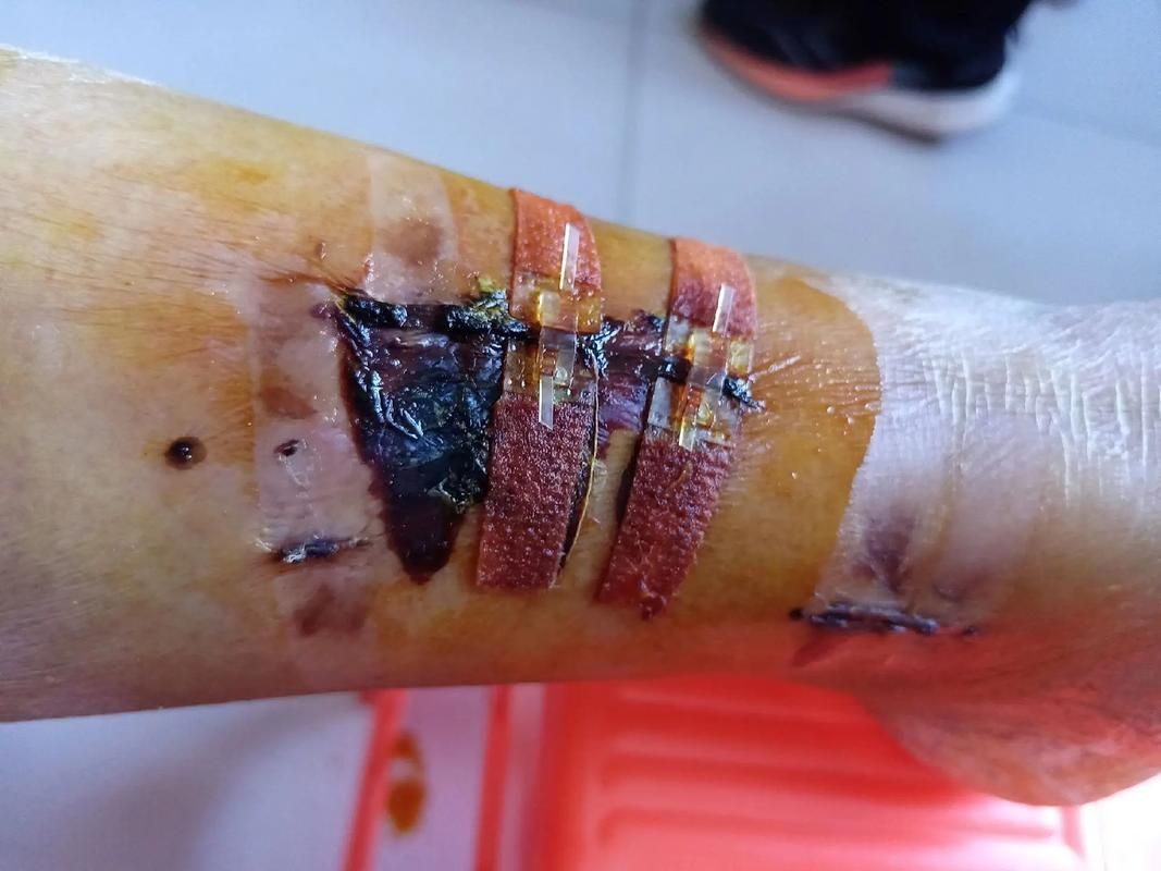 能否提供龍魚傷口愈合的詳細(xì)圖片，龍魚傷口愈合的詳細(xì)圖片描述：龍魚傷口愈合過程的詳細(xì)圖片描述