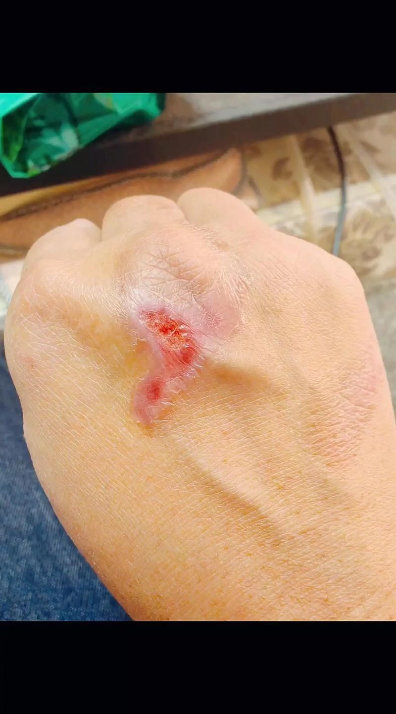 能否提供龍魚傷口愈合的詳細(xì)圖片，龍魚傷口愈合的詳細(xì)圖片描述：龍魚傷口愈合過程的詳細(xì)圖片描述