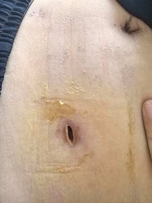 能否提供龍魚傷口愈合的詳細(xì)圖片，龍魚傷口愈合的詳細(xì)圖片描述：龍魚傷口愈合過程的詳細(xì)圖片描述