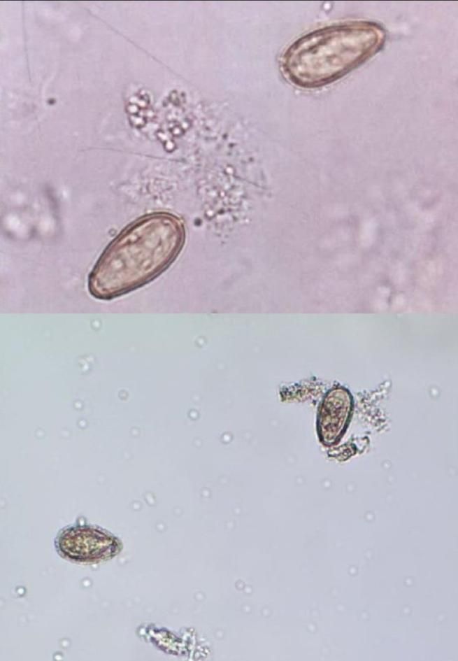 如何安全地烹飪魚以確保殺死所有寄生蟲